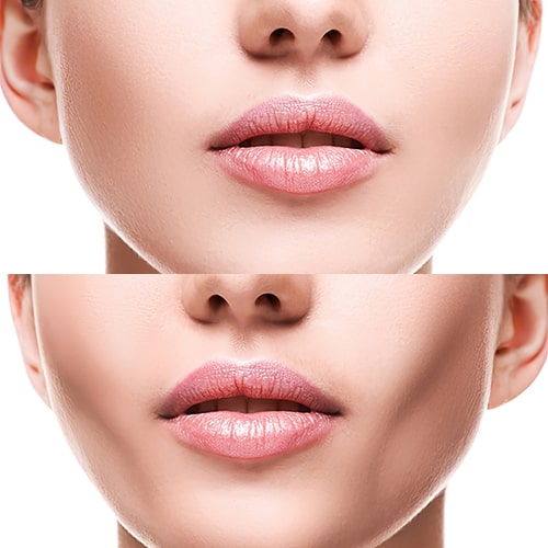 Yılan Yapısı 59461295