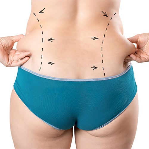 Yılan Yapısı 1968194315