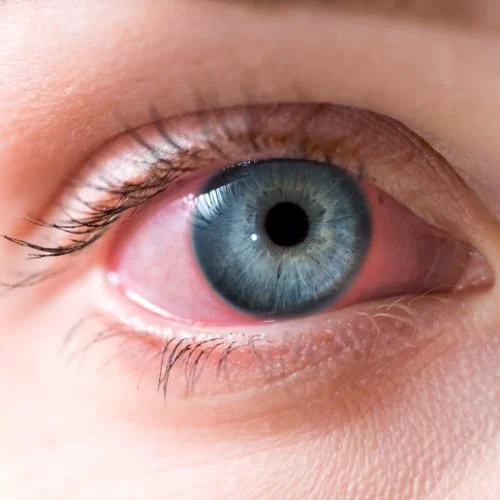 Yılan Yapısı 1757630705