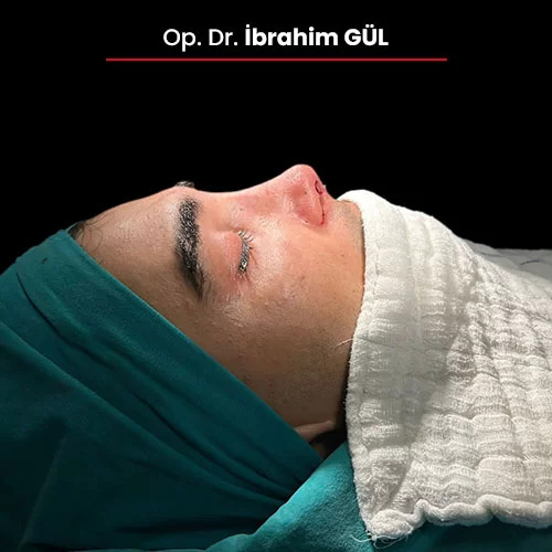 Öncesi Sonrası 330087669