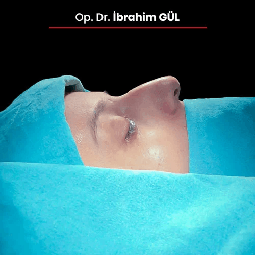 Öncesi Sonrası 1183372485