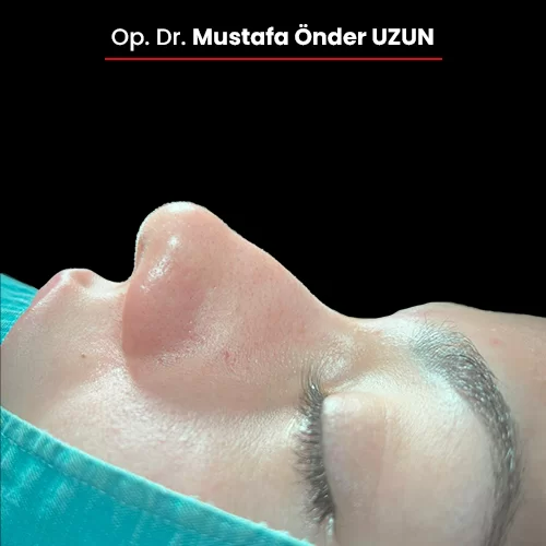 Öncesi Sonrası 1599461963