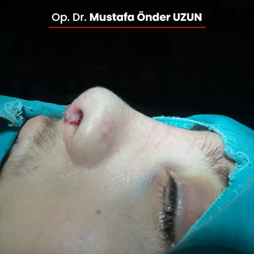 Öncesi Sonrası 1080784905