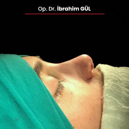 Öncesi Sonrası 781199278