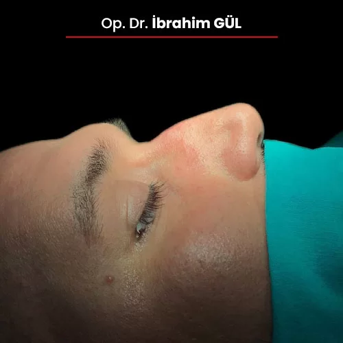 Öncesi Sonrası 1260754217