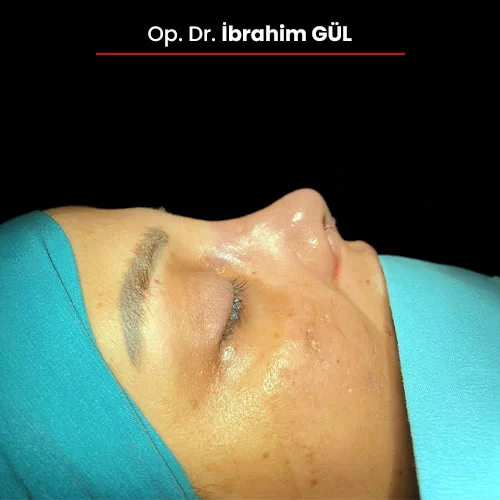 Öncesi Sonrası 2092172131