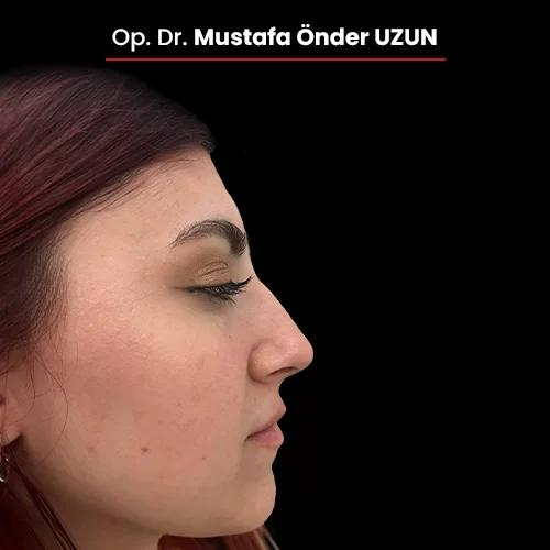 Öncesi Sonrası 1658038773