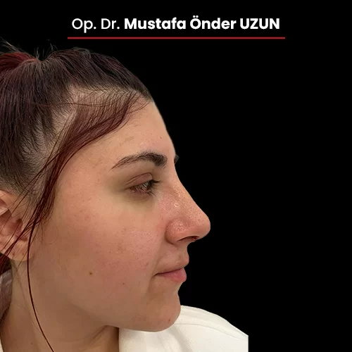 Öncesi Sonrası 1658038773