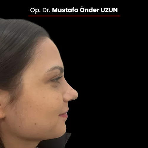 Öncesi Sonrası 1301601917