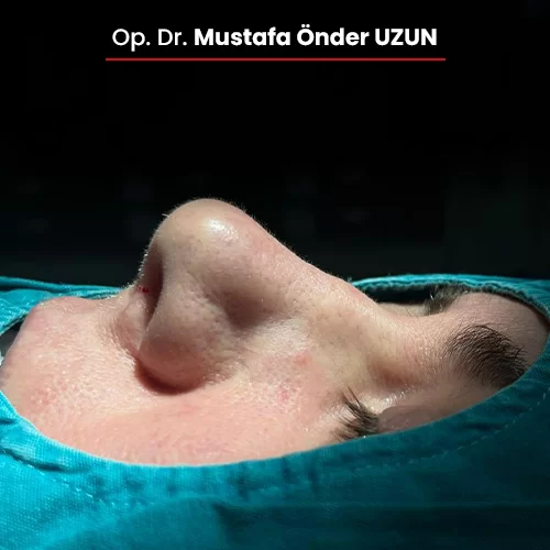 Öncesi Sonrası 1847402041