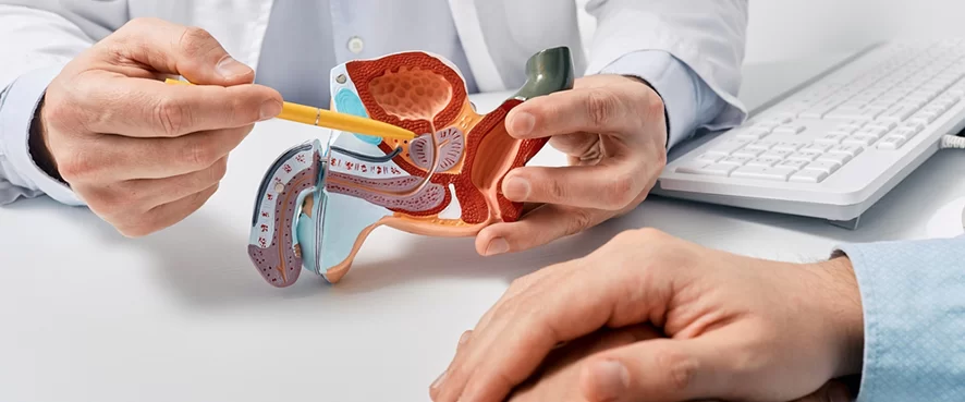 Prostate Cancer – Symptoms, Stages and Treatment