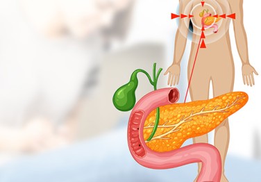 Endoscopic Retrograde Cholangiopancreatography (ERCP): A Modern Method for Diagnosis and Treatment of Biliary, Pancreatic and Liver Diseases