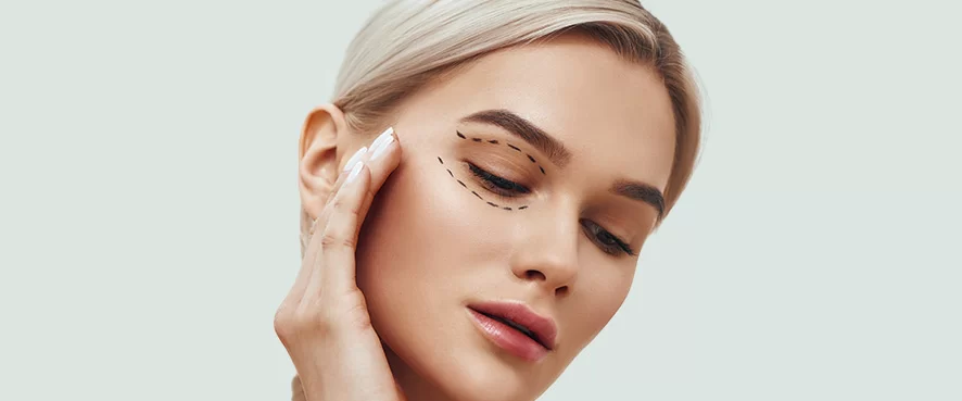 What Is Eyelid Aesthetics (Blepharoplasty)?